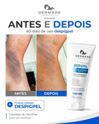 Kit 6 unidades de Despigpel