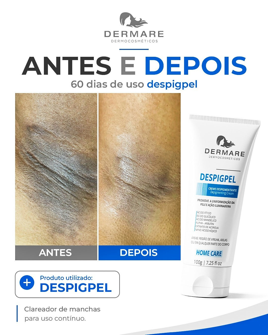 Despigpel - 100g